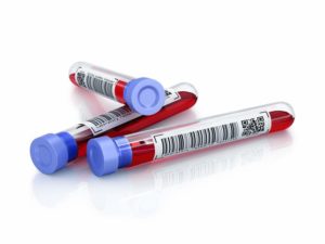bts analyses de biologie médicale à l'ESTBA