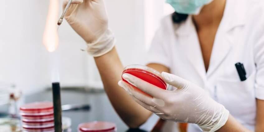 licence pro en alternance bac +3 : Biologie analytique et expérimentale, parcours microbiologie