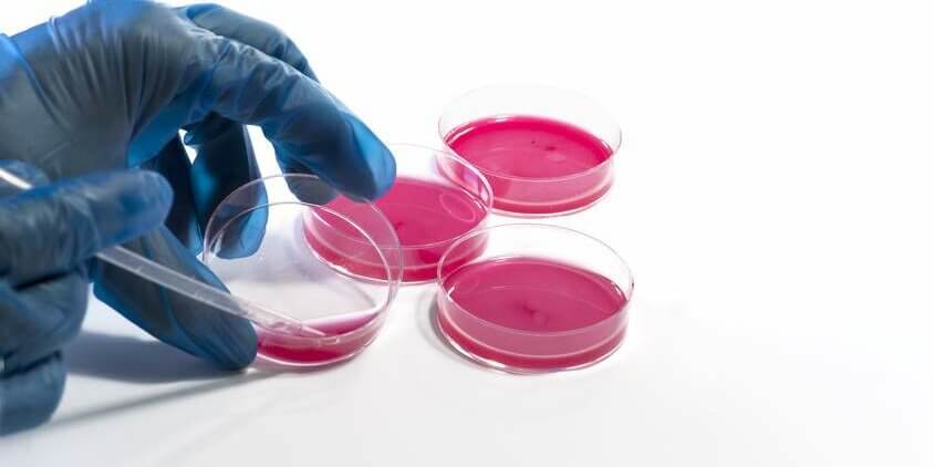 BTS BIOTECHNOLOGIES à l'ESTBA permet de travailler soit dans la recherche soit dans l'industrie